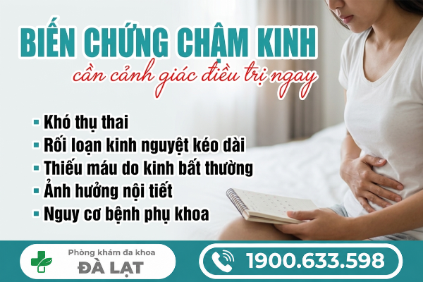 Hình ảnh minh họa